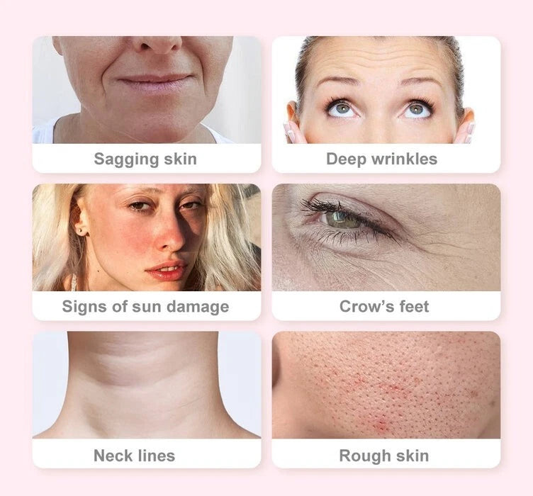 REJUVENECEDOR FACIAL 4 EN 1